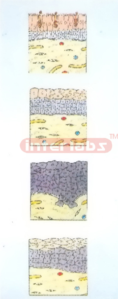 HANGING THE SMOKING ENDANGERS LUNG MODEL